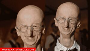 Progeria sammy basso